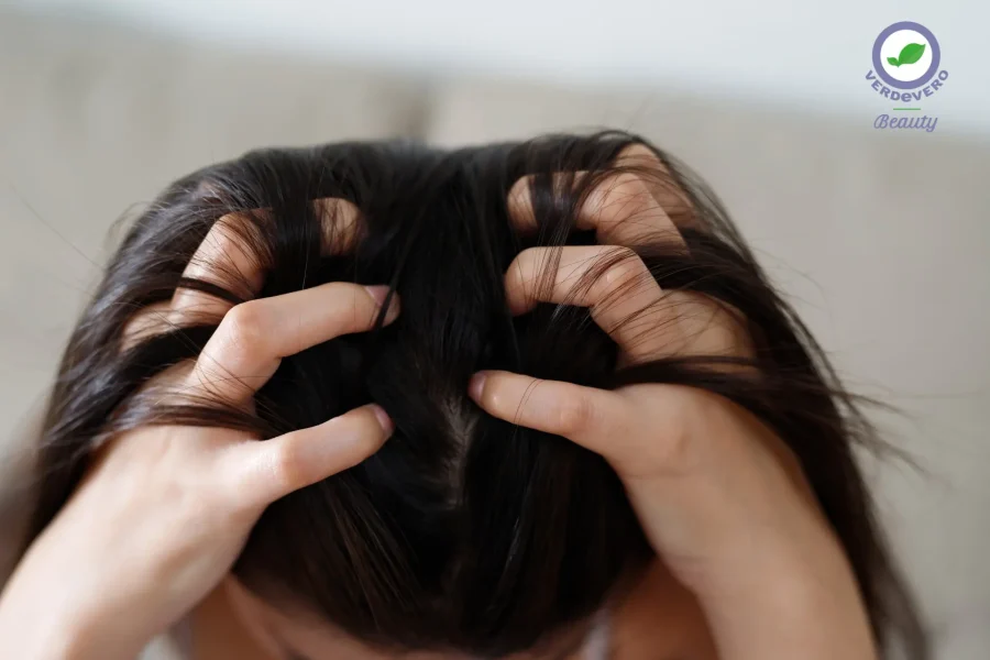 irritazione cuoio capelluto